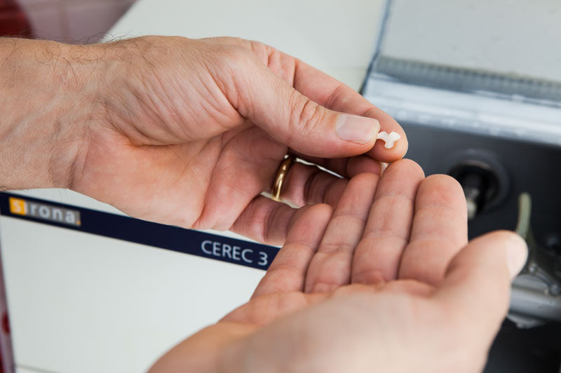 Nahaufnahme von Händen, die ein frisch gefrästes Keramikelement aus der CEREC 3-Maschine entnehmen – Teil einer computergestützten Zahnversorgung.